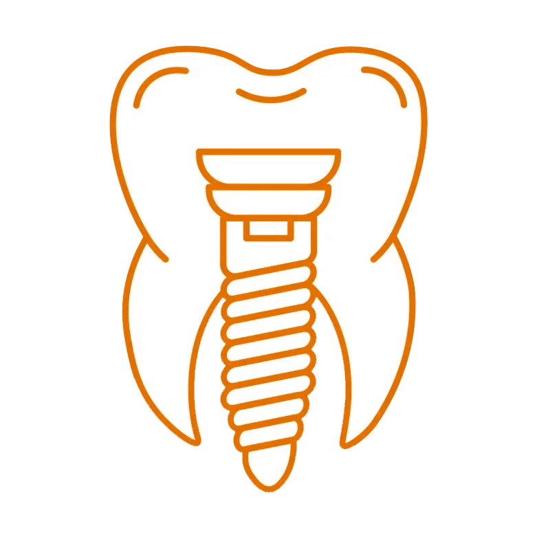 Zygomatic-Implants